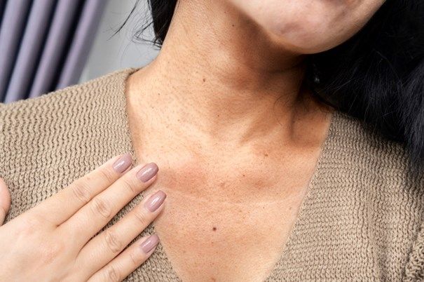 Ova suptilna promjena na koži mogla bi biti rani simptom tihog ubice