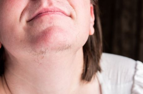 ZNATE LI ZAŠTO SE KOD ŽENA JAVLJAJU DLAČICE NA BRADI? Evo šta vam organizam govori