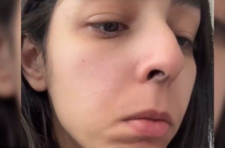 Probudila se sa crnim nosom, ubrzo je shvatila istinu (VIDEO)