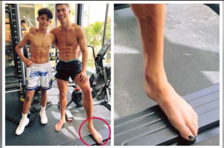 Zašto su Ronaldovi nokti na nogama obojeni u crno? On za to ima dobar razlog