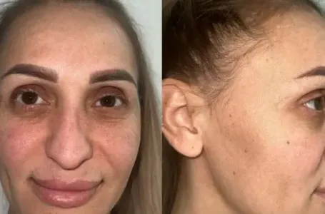 Žena otišla na operaciju i potpuno promijenila lični opis: "Trebat će joj novi lični dokumenti"