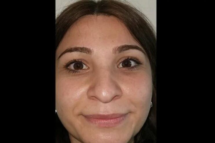 TURSKI DOKTORI SU JE PREPORODILI: Ovako je izgledala prije operacije, a da je vidite sada (FOTO)