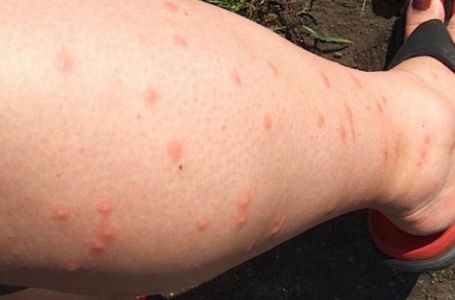 IZLUĐUJU VAS KOMARCI? Razrežite OVO VOĆE na pola i ostavite u ćošak, NIKADA IH VIŠE NEĆETE VIDJETI