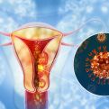 Koje žene su u povećanom riziku za razvoj karcinoma materice: Jedan simptom je znak za hitan odlazak