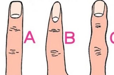 POGLEDAJTE SVOJE RUKE: Oblik prstiju otkriva vaše prikrivene osobine