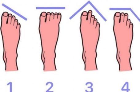 OBLIK VAŠIH STOPALA POKAZUJE KAKAV STE ČOVJEK: Dobro pogledajte noge, otkriće vam mnogo
