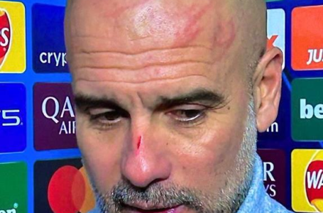 GUARDIOLA KRVAV I MODAR STAO PRED KAMERE: Zaprepašteni novinari pitali šta se desilo, a odgovor...