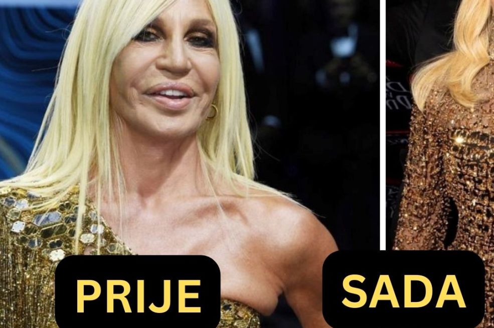 Donatella Versace zbunila sve novim slikama: "PONIŠTILA LOŠE OPERACIJE"? (FOTO)