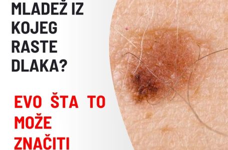 IMATE LI MLADEŽ IZ KOJEG RASTE DLAKA? Evo šta to može značiti
