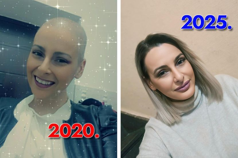 Jasmina prošla 31 zračenje i 16 hemioterapija: Ovo je prvi simptom raka dojke koji je imala