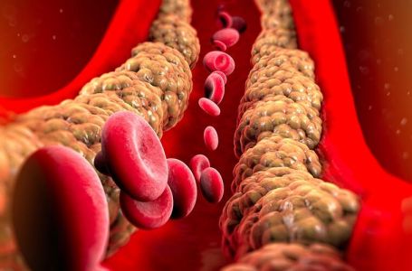 Holesterol ne skače od mesa, već od ove 2 stvari koje su smrt za jetru i samo gomilaju masnoću