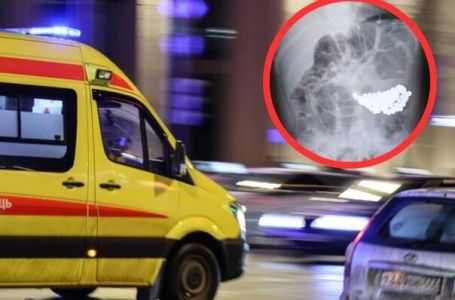 Tragedija u Rusiji: Dječak (2) preminuo nakon što je odjednom progutao 18 magneta