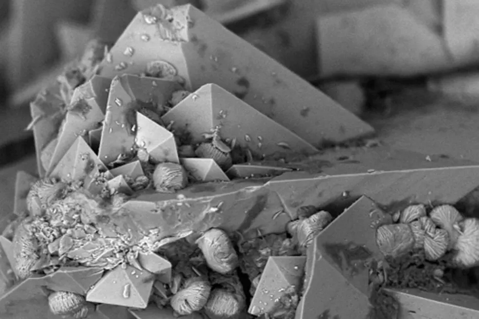 NAUČNICI POTVRDILI: Ova bol je za većinu ljudi najgora moguća