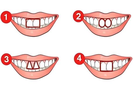 Šta vaši zubi govore o vama? Nasmijte se i otkrijte KAKVA STE OSOBA