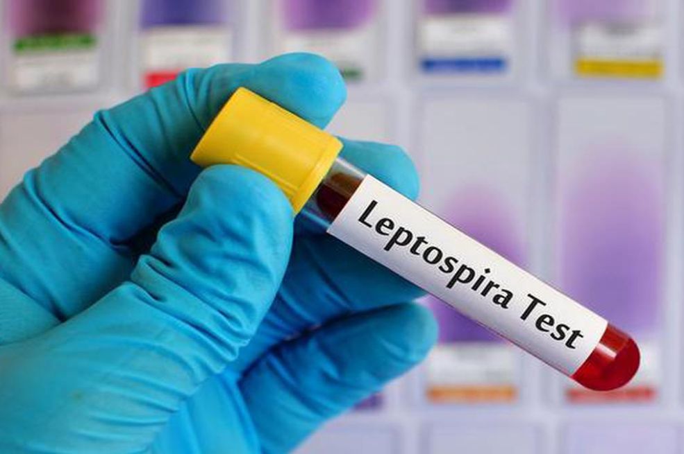 Infektologinja iz Sarajeva upozorava: Najteži oblici leptospiroze mogu završiti smrću