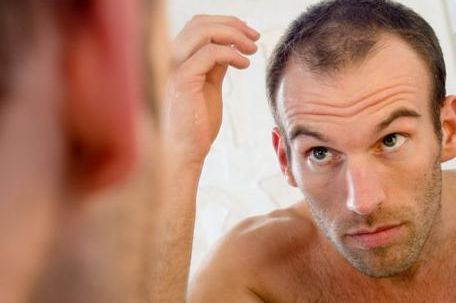 Brzi test otkriva da li ćete oćelaviti – pogledajte jedan dio tijela!