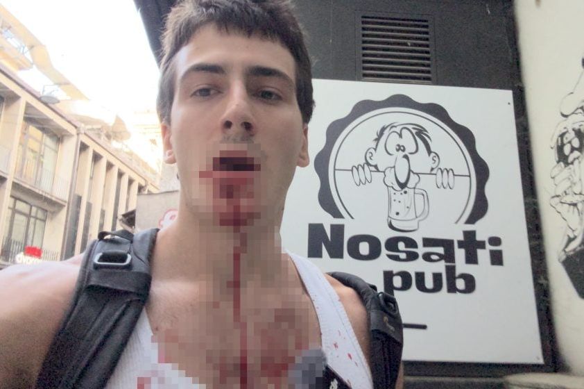 U ‘Ćacilendu’ pretučen jutjuber Nevenclips tokom snimanja reportaže