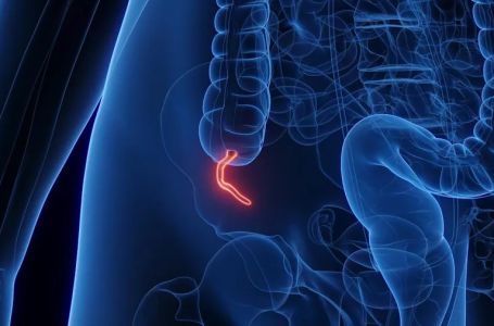 Alarmatni porast oboljenja od ove vrste raka kod milenijalaca