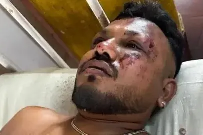 ON JE PREŽIVIO STRAVIČAN PAD AVIONA! "Tijela su bila svuda": Prije katastrofe je čuo JEDAN ZVUK