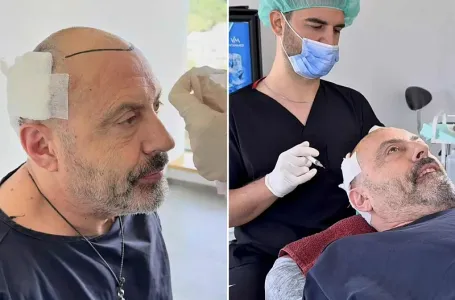 Sejo Sexon presadio kosu: Ovako bh. muzičar izgleda nakon zahvata