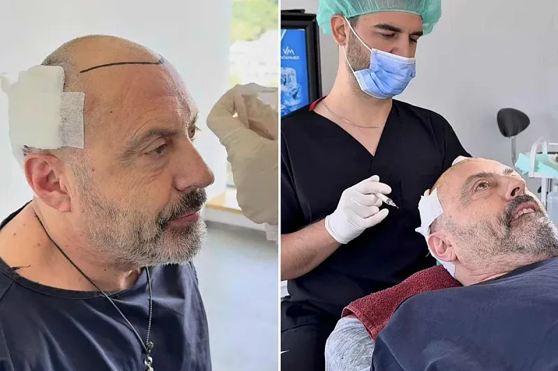 Sejo Sexon presadio kosu: Ovako bh. muzičar izgleda nakon zahvata