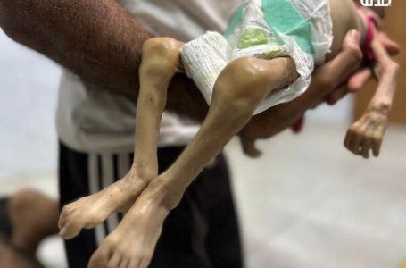 Šestomjesečna beba preminula majci na rukama u Gazi