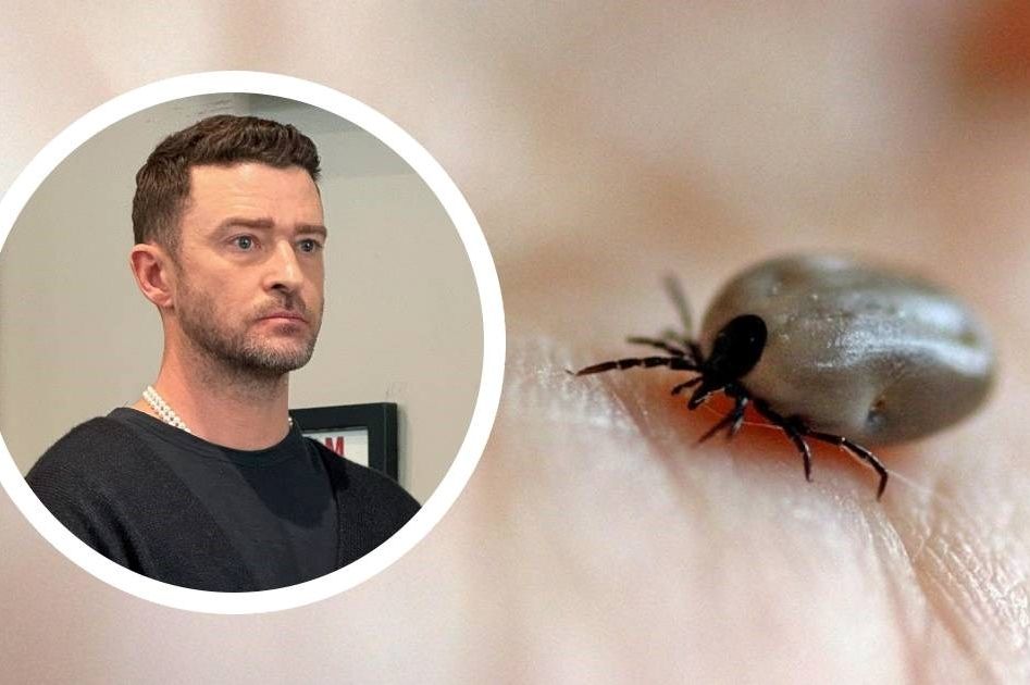 Justin Timberlake ima lajmsku bolest: Ovo su simptomi koje ne smijete ignorirati