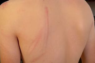 “Šutirali nas, udarali pendrecima, a u marici su nas najviše tukli” — svedočenje maloletnika