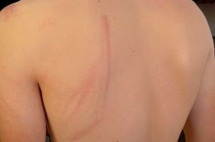 “Šutirali nas, udarali pendrecima, a u marici su nas najviše tukli” — svedočenje maloletnika