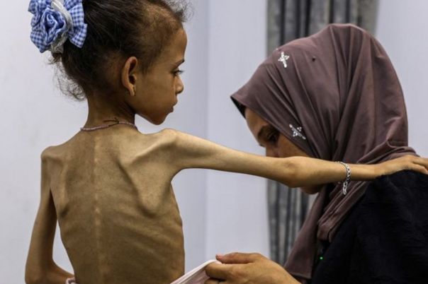 U Gazi zvanično potvrđena glad!