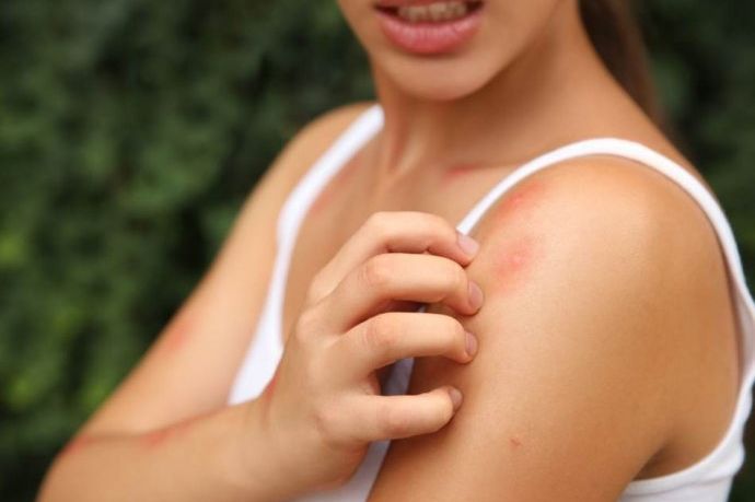 EU upozorava: Rekordna epidemija virusa koje prenose komarci prijeti Evropljanima ovog ljeta