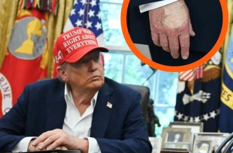 Svi gledaju u ruke Donalda Trumpa: 1 detalj privlači pažnju