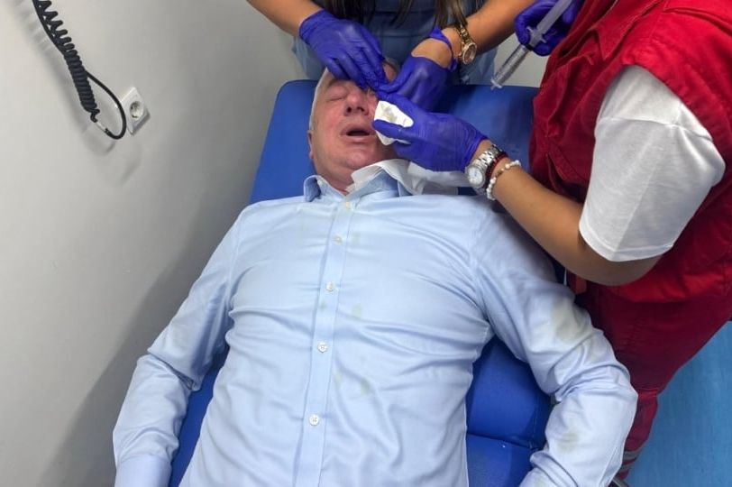 Branislav Borenović večeras napadnut: Policija reagovala, poslanik prebačen u bolnicu