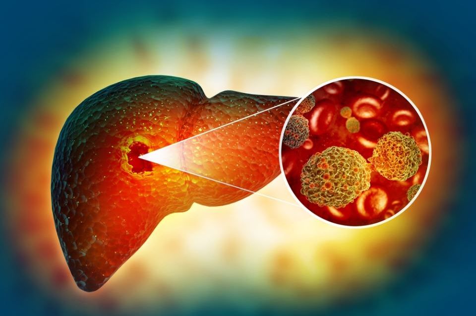 Prvi simptom raka jetre javlja se dok jedemo: Mnogi ljudi ga ignorišu misleći da je do loše hrane