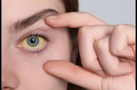 Simptomi raka pankreasa na koži: Rani znaci koje ne smijete ignorisati, odmah provjerite