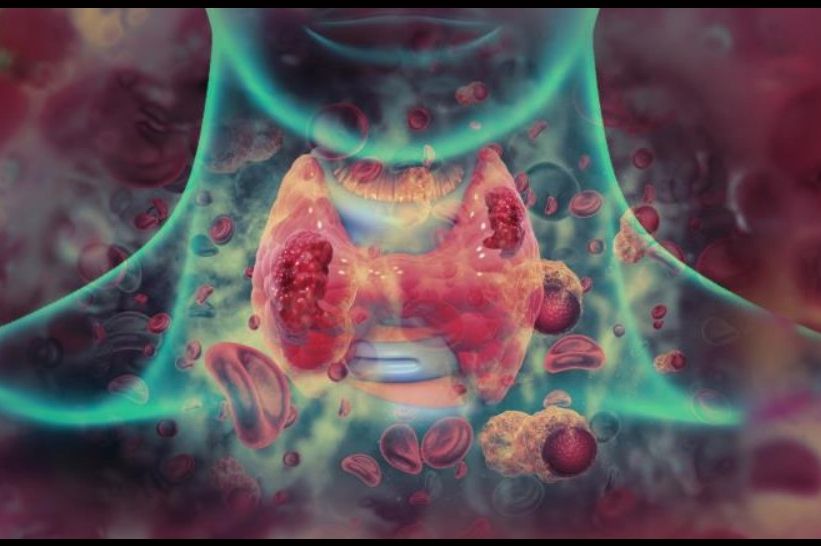 Ovih 7 simptoma raka grla ne smijete ignorisati! Često se miješaju sa bezazlenim infekcijama