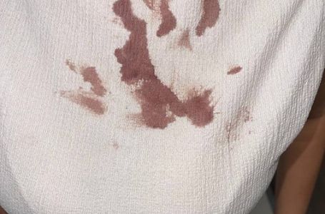 Studenti koji su u blokadi tvrde da je njihova koleginica brutalno zlostavljana u policiji