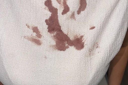 Studenti koji su u blokadi tvrde da je njihova koleginica brutalno zlostavljana u policiji