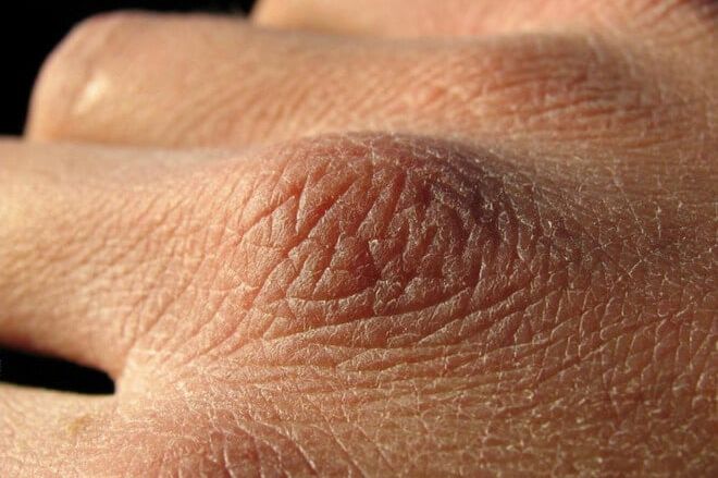 Puca vam koža, opada kosa ili imate grčeve? Tijelo vam govori da vam nedostaju ovi vitamini