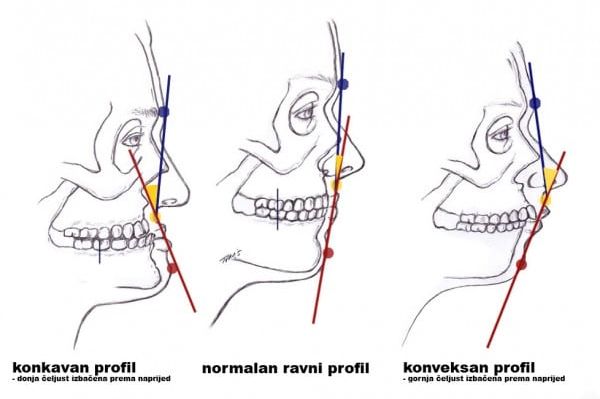 Imate li konveksan, vertikalan ili konkavan profil? Evo što to govori o vašem karakteru!