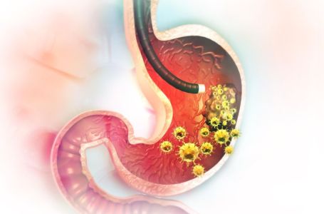 5 ranih simptoma raka želuca: Tumor može da raste godinama, a svi pacijenti prvo osjete ovo
