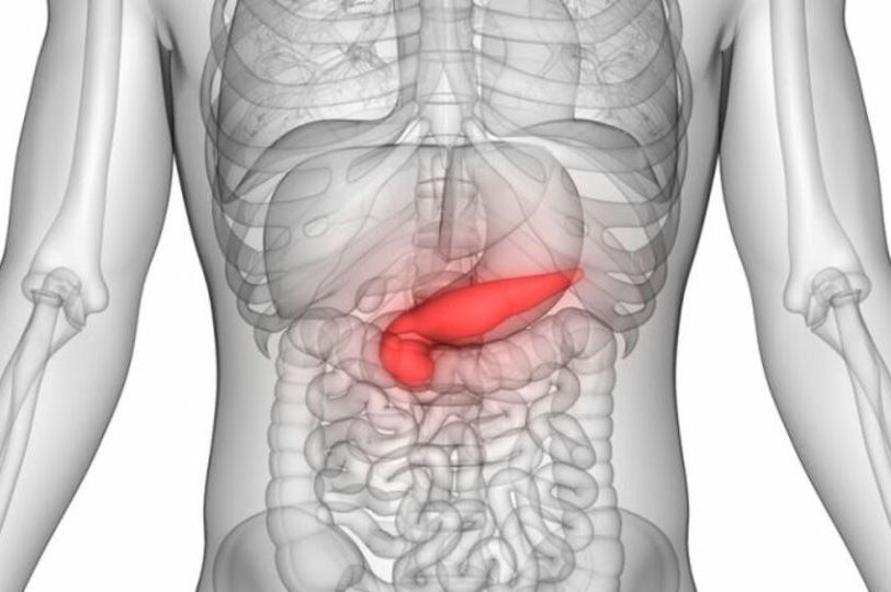 Bol u ovom dijelu leđa može biti najraniji znak raka pankreasa: Ovo je spisak svih simptoma bolesti