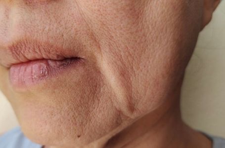 Dva neobična simptoma u ustima otkrivaju manjak vitamina B12