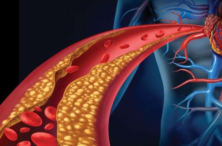 Holesterol ne skače od mesa, već od ove 2 stvari koje su smrt za jetru i samo gomilaju masnoću