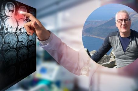 Nije znao da je doživio moždani udar: Imao je samo 1 rijedak simptom koji pogađa manje od 1% ljudi