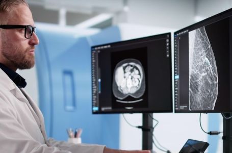 "Ja sam onkolog i molim ljude preko 50 da ovaj pregled obavezno urade"