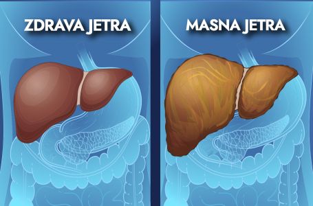 3 voća i 3 povrća koja su melem za jetru nakon 50. godine