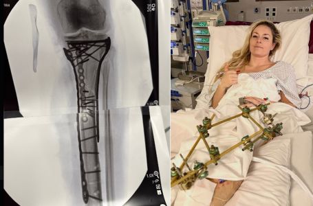 Vonn objavila sliku i otkrila kako se osjeća