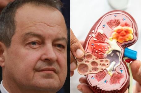 Ivica Dačić ne boluje samo od upale pluća, ovu bolest je ignorisao godinama, a tiho razara organe