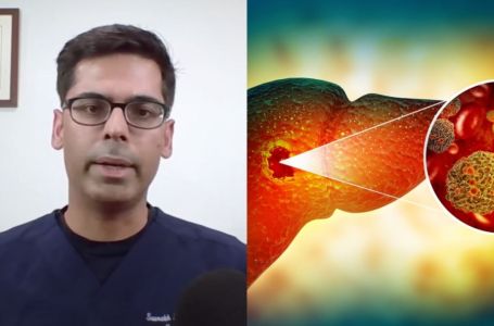 8 znakova da vam jetra ne radi kako treba: Tvrdi vodeći hepatolog